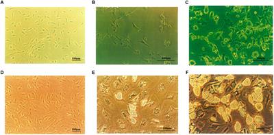 Ghrelin Promotes Proliferation and Inhibits Differentiation of 3T3-L1 and Human Primary Preadipocytes